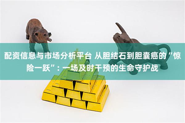 配资信息与市场分析平台 从胆结石到胆囊癌的“惊险一跃”: 一场及时干预的生命守护战